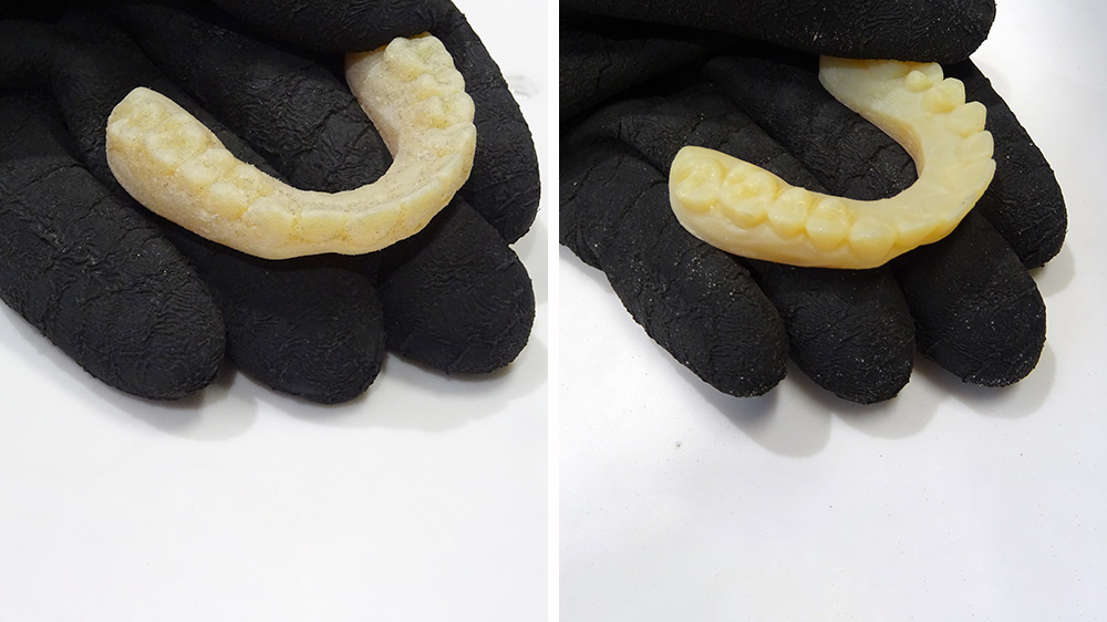 Reinigungstest Gebiss Krumm-tec